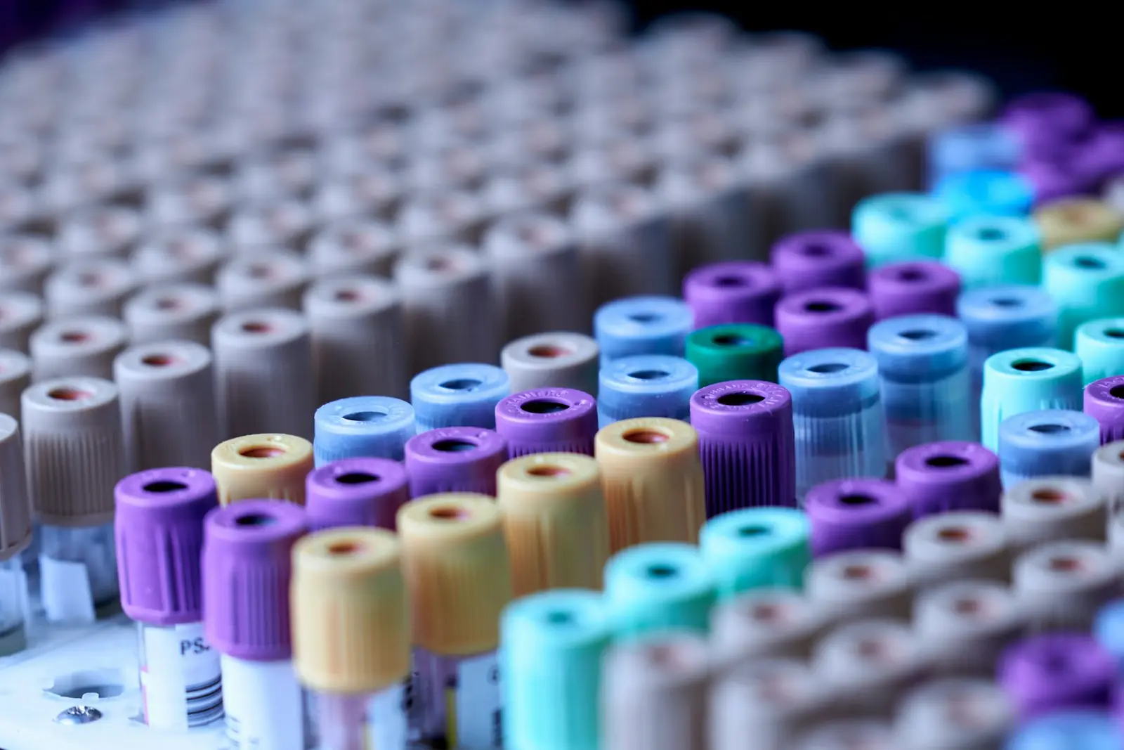 Rack of sample tubes with purple, teal, yellow and grey caps lined up in a diagnostic laboratory