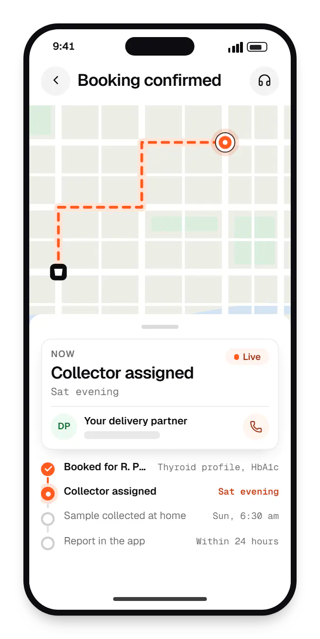 UI/UX design confirmation order tracking on a phone, with live status steps